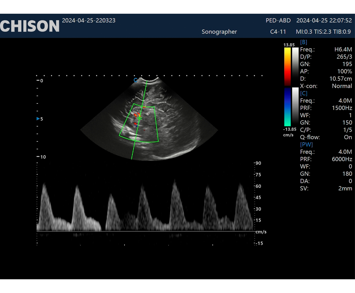 SonoMax Sonograph