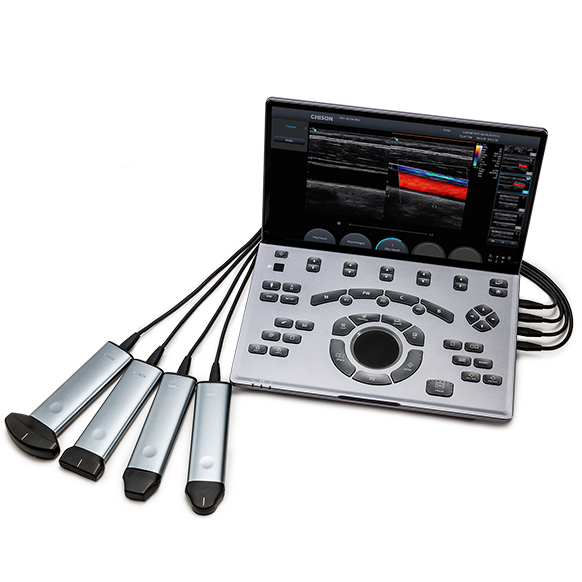 SonoAir 30 imagen 6