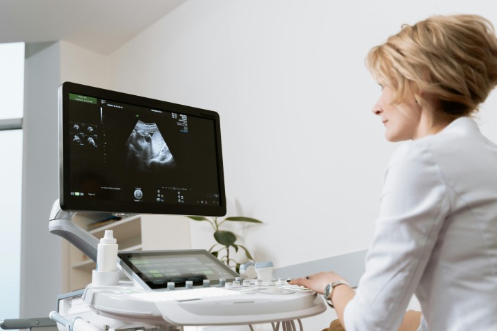 Cómo elegir ecógrafo para ginecología y obstetricia: sondas, Doppler y presupuesto